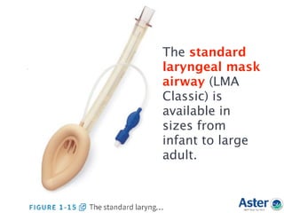 The standard
laryngeal mask
airway (LMA
Classic) is
available in
sizes from
infant to large
adult.
 