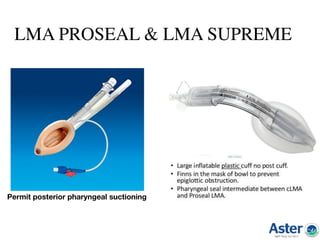 LMA PROSEAL & LMA SUPREME
Permit posterior pharyngeal suctioning
 
