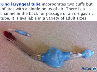 King laryngeal tube incorporates two cuffs but
inﬂates with a single bolus of air. There is a
channel in the back for passage of an orogastric
tube. It is available in a variety of adult sizes.
 