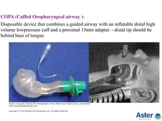 COPA (Cuffed Oropharyngeal airway )-
Disposable device that combines a guided airway with an inflatable distal high
volume lowpressure cuff and a proximal 15mm adapter. - distal tip should be
behind base of tongue
 