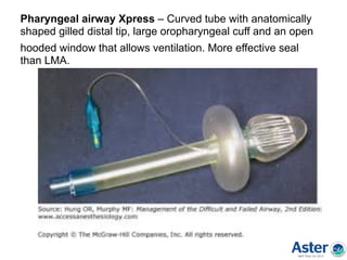 Pharyngeal airway Xpress – Curved tube with anatomically
shaped gilled distal tip, large oropharyngeal cuff and an open
hooded window that allows ventilation. More effective seal
than LMA.
 
