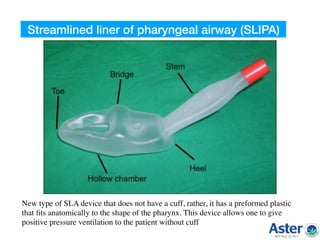 New type of SLA device that does not have a cuff, rather, it has a preformed plastic
that ﬁts anatomically to the shape of the pharynx. This device allows one to give
positive pressure ventilation to the patient without cuff
Streamlined liner of pharyngeal airway (SLIPA)
 