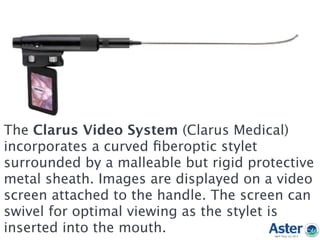 The Clarus Video System (Clarus Medical)
incorporates a curved ﬁberoptic stylet
surrounded by a malleable but rigid protective
metal sheath. Images are displayed on a video
screen attached to the handle. The screen can
swivel for optimal viewing as the stylet is
inserted into the mouth.
 