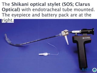 The Shikani optical stylet (SOS; Clarus
Optical) with endotracheal tube mounted.
The eyepiece and battery pack are at the
right.
 