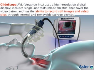 GlideScope AVL (Verathon Inc.) uses a high-resolution digital
display; includes single-use Stats (blade sheaths) that cover the
video baton; and has the ability to record still images and video
clips through internal and removable storage devices.
 