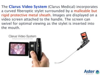 The Clarus Video System (Clarus Medical) incorporates
a curved ﬁberoptic stylet surrounded by a malleable but
rigid protective metal sheath. Images are displayed on a
video screen attached to the handle. The screen can
swivel for optimal viewing as the stylet is inserted into
the mouth.
 
