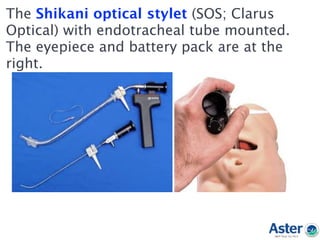 The Shikani optical stylet (SOS; Clarus
Optical) with endotracheal tube mounted.
The eyepiece and battery pack are at the
right.
 