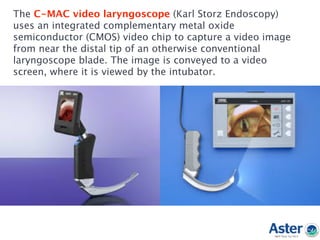 The C-MAC video laryngoscope (Karl Storz Endoscopy)
uses an integrated complementary metal oxide
semiconductor (CMOS) video chip to capture a video image
from near the distal tip of an otherwise conventional
laryngoscope blade. The image is conveyed to a video
screen, where it is viewed by the intubator.
 