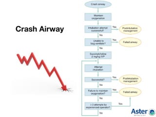 Crash Airway
 