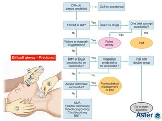 Difﬁcult airway - Predicted
 