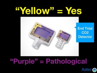 “Yellow” = Yes
“Purple” = Pathological
End Tidal
CO2
Detector
 