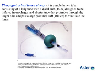 Difficult airway : Made easy | PPT