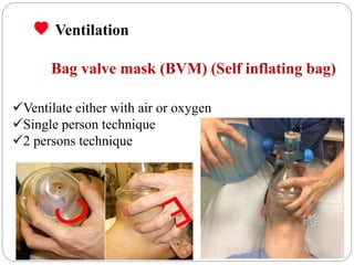 airway management recorded for S2.pptx