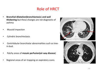 111
Role of HRCT
• Bronchial dilatation(bronchiectasis) and wall
thickening-but these changes are not diagnostic of
asthma
• Mucoid impaction
• Cylindric bronchiectasis
• Centrilobular bronchiolar abnormalities such as tree-
in-bud.
• Patchy areas of mosaic perfusion(air way disease)
• Regional areas of air-trapping on expiratory scans
 