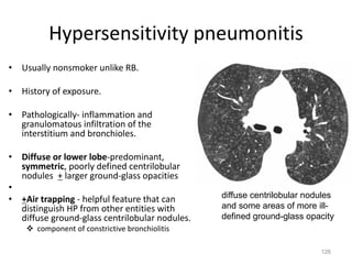 126
Hypersensitivity pneumonitis
• Usually nonsmoker unlike RB.
• History of exposure.
• Pathologically- inflammation and
granulomatous infiltration of the
interstitium and bronchioles.
• Diffuse or lower lobe-predominant,
symmetric, poorly defined centrilobular
nodules + larger ground-glass opacities
•
• +Air trapping - helpful feature that can
distinguish HP from other entities with
diffuse ground-glass centrilobular nodules.
v component of constrictive bronchiolitis
diffuse centrilobular nodules
and some areas of more ill-
defined ground-glass opacity
 