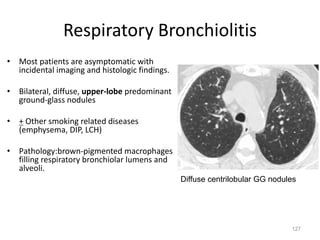 127
Respiratory Bronchiolitis
• Most patients are asymptomatic with
incidental imaging and histologic findings.
• Bilateral, diffuse, upper-lobe predominant
ground-glass nodules
• + Other smoking related diseases
(emphysema, DIP, LCH)
• Pathology:brown-pigmented macrophages
filling respiratory bronchiolar lumens and
alveoli.
Diffuse centrilobular GG nodules
 