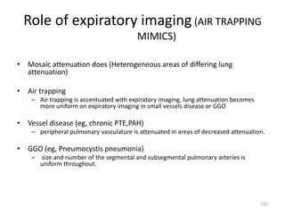 132
Role of expiratory imaging (AIR TRAPPING
MIMICS)
• Mosaic attenuation does (Heterogeneous areas of differing lung
attenuation)
• Air trapping
– Air trapping is accentuated with expiratory imaging, lung attenuation becomes
more uniform on expiratory imaging in small vessels disease or GGO
• Vessel disease (eg, chronic PTE,PAH)
– peripheral pulmonary vasculature is attenuated in areas of decreased attenuation.
• GGO (eg, Pneumocystis pneumonia)
– size and number of the segmental and subsegmental pulmonary arteries is
uniform throughout.
 