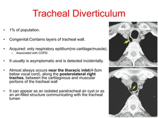 46
Tracheal Diverticulum
• 1% of population.
• Congenital:Contains layers of tracheal wall.
• Acquired: only respiratory epitilium(no cartilage/muscle).
– Associated with COPD.
• It usually is asymptomatic and is detected incidentally.
• Almost always occurs near the thoracic inlet(4-5cm
below vocal cord), along the posterolateral right
trachea, between the cartilaginous and muscular
portions of the tracheal wall
• It can appear as an isolated paratracheal air cyst or as
an air-filled structure communicating with the tracheal
lumen
 