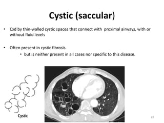 61
Cystic (saccular)
• Cxd by thin-walled cystic spaces that connect with proximal airways, with or
without fluid levels
• Often present in cystic fibrosis.
• but is neither present in all cases nor specific to this disease.
 