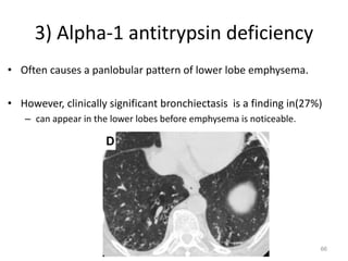 66
3) Alpha-1 antitrypsin deficiency
• Often causes a panlobular pattern of lower lobe emphysema.
• However, clinically significant bronchiectasis is a finding in(27%)
– can appear in the lower lobes before emphysema is noticeable.
 