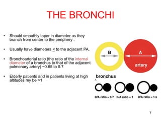 7
THE BRONCHI
• Should smoothly taper in diameter as they
branch from center to the periphery .
• Usually have diameters < to the adjacent PA.
• Bronchoarterial ratio (the ratio of the internal
diameter of a bronchus to that of the adjacent
pulmonary artery) ~0.65 to 0.7
• Elderly patients and in patients living at high
altitudes my be >1
 