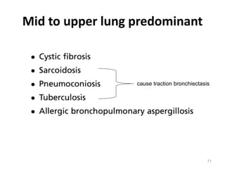 71
Mid to upper lung predominant
cause traction bronchiectasis
 