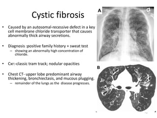 72
Cystic fibrosis
• Caused by an autosomal-recessive defect in a key
cell membrane chloride transporter that causes
abnormally thick airway secretions.
• Diagnosis :positive family history + sweat test
– showing an abnormally high concentration of
chloride.
• Cxr:-classic tram track; nodular opacities
• Chest CT- upper lobe predominant airway
thickening, bronchiectasis, and mucous plugging.
– remainder of the lungs as the disease progresses.
 