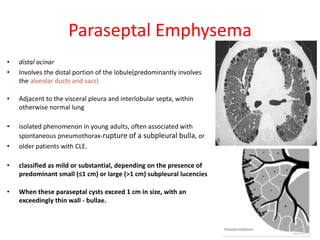 94
Paraseptal Emphysema
• distal acinar
• Involves the distal portion of the lobule(predominantly involves
the alveolar ducts and sacs)
• Adjacent to the visceral pleura and interlobular septa, within
otherwise normal lung
• isolated phenomenon in young adults, often associated with
spontaneous pneumothorax-rupture of a subpleural bulla, or
• older patients with CLE.
• classified as mild or substantial, depending on the presence of
predominant small (≤1 cm) or large (>1 cm) subpleural lucencies
• When these paraseptal cysts exceed 1 cm in size, with an
exceedingly thin wall - bullae.
 