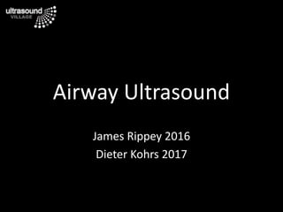 Airway Ultrasound
James Rippey 2016
Dieter Kohrs 2017
 