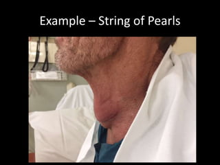 Airway ultrasound | PPTX