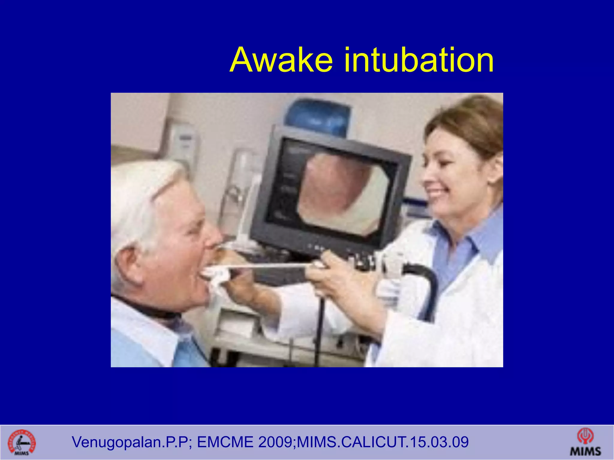 Venugopalan.P.P; EMCME 2009;MIMS.CALICUT.15.03.09
Awake intubation
 