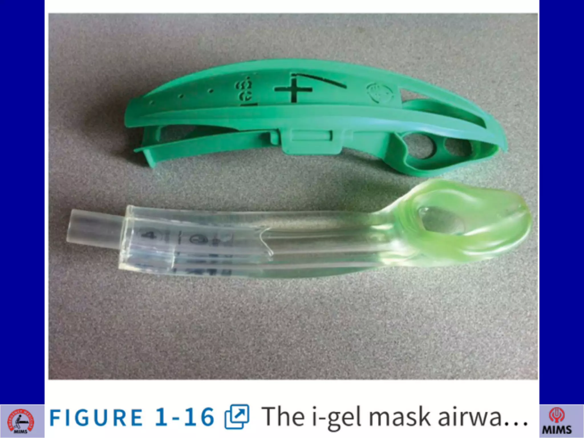 Venugopalan.P.P; EMCME 2009;MIMS.CALICUT.15.03.09
 