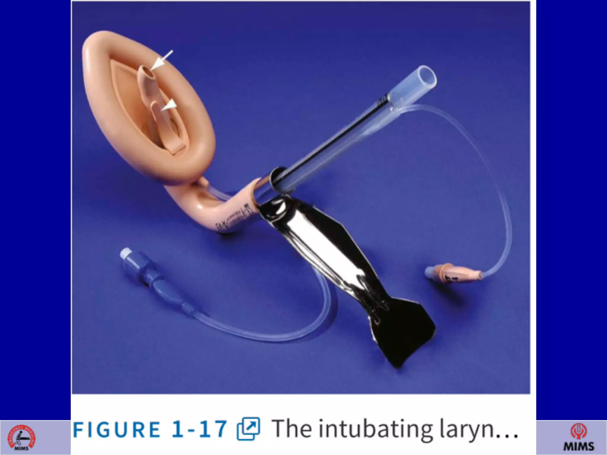 Venugopalan.P.P; EMCME 2009;MIMS.CALICUT.15.03.09
 