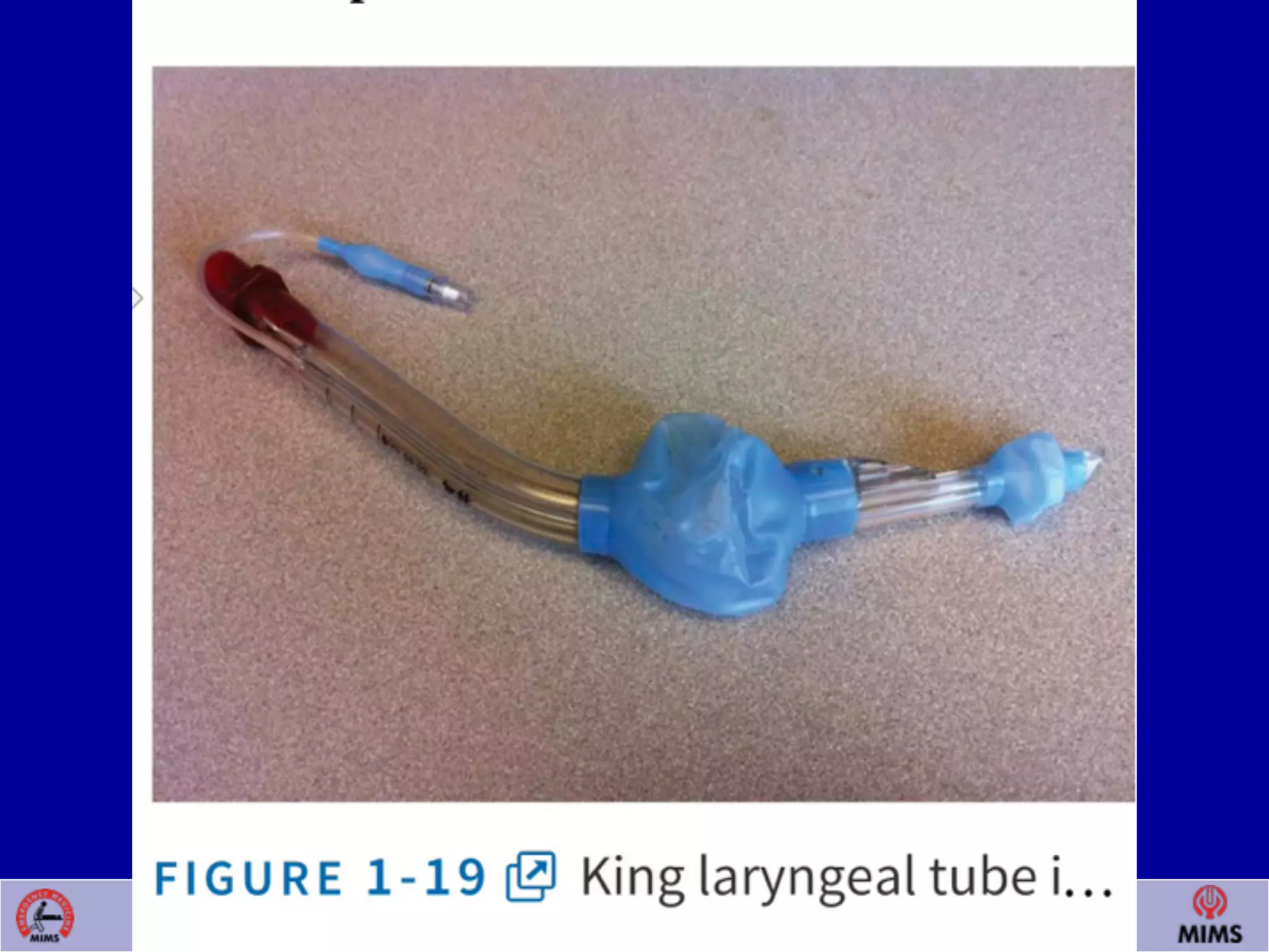 Venugopalan.P.P; EMCME 2009;MIMS.CALICUT.15.03.09
 