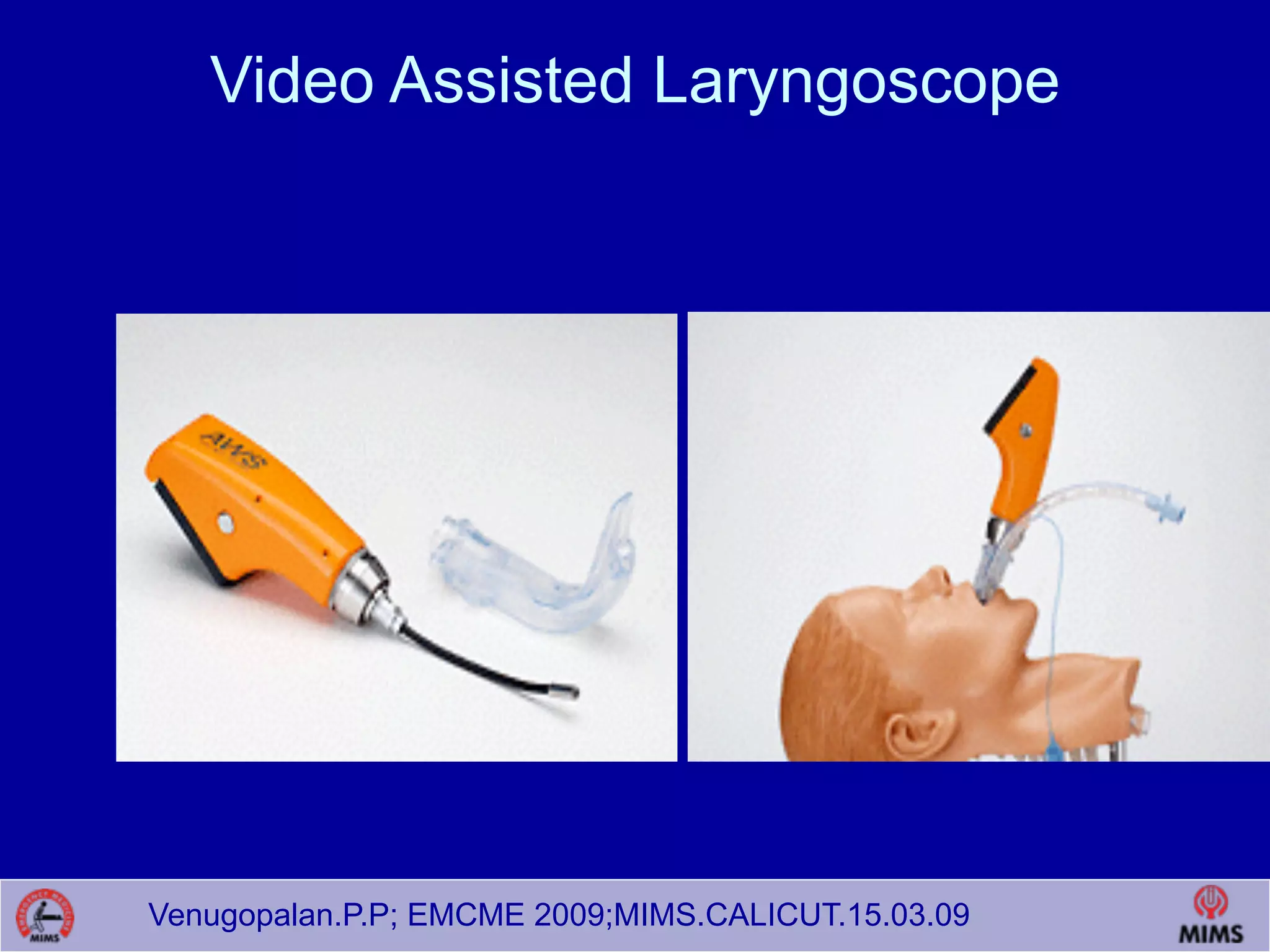 Venugopalan.P.P; EMCME 2009;MIMS.CALICUT.15.03.09
Video Assisted Laryngoscope 
 