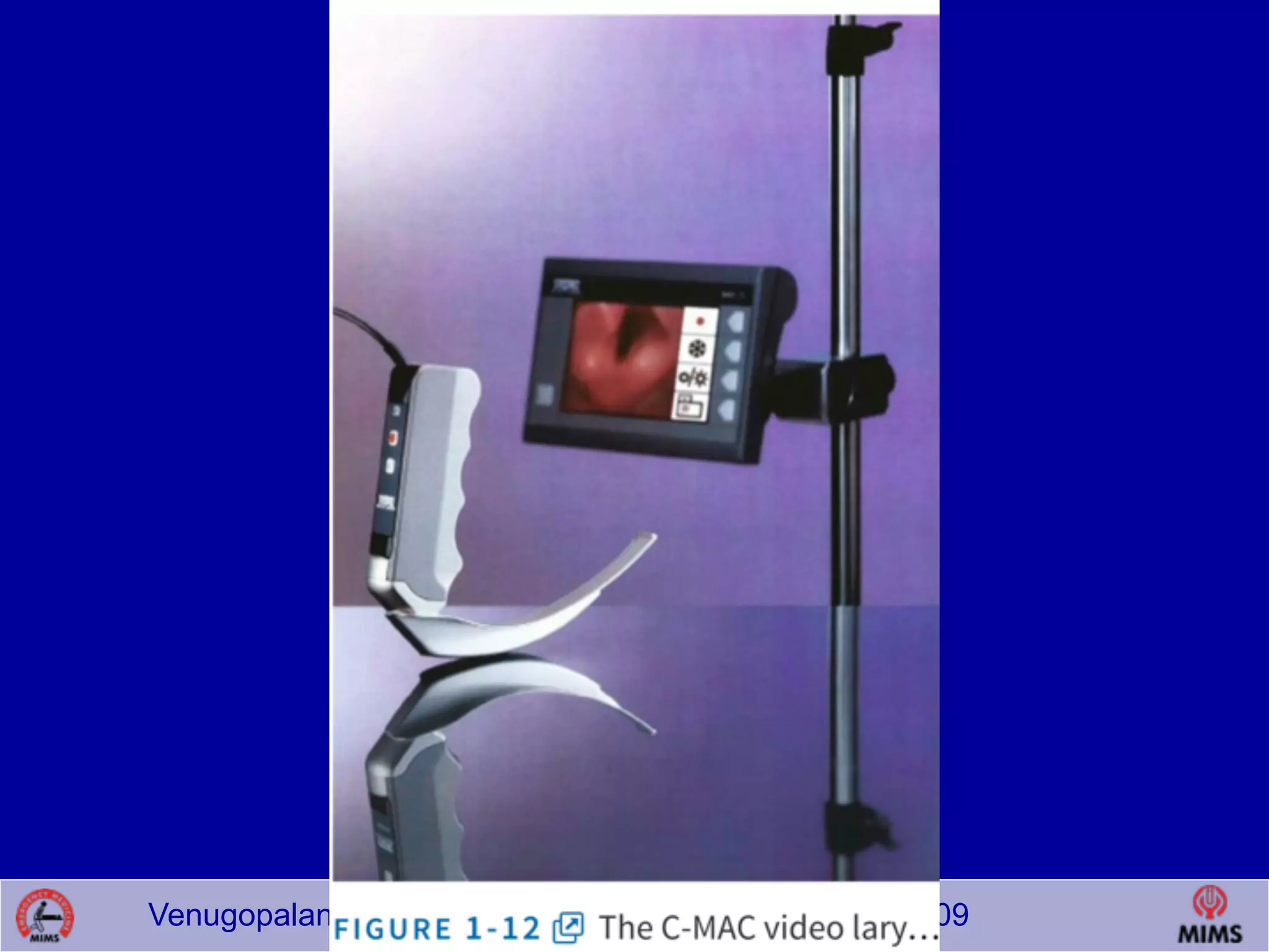 Venugopalan.P.P; EMCME 2009;MIMS.CALICUT.15.03.09
 