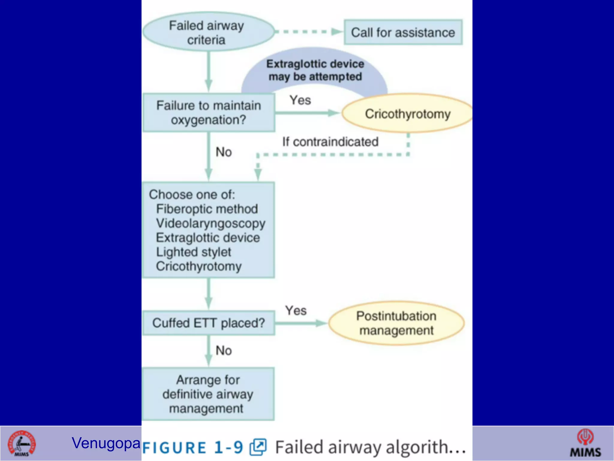 Venugopalan.P.P; EMCME 2009;MIMS.CALICUT.15.03.09
 