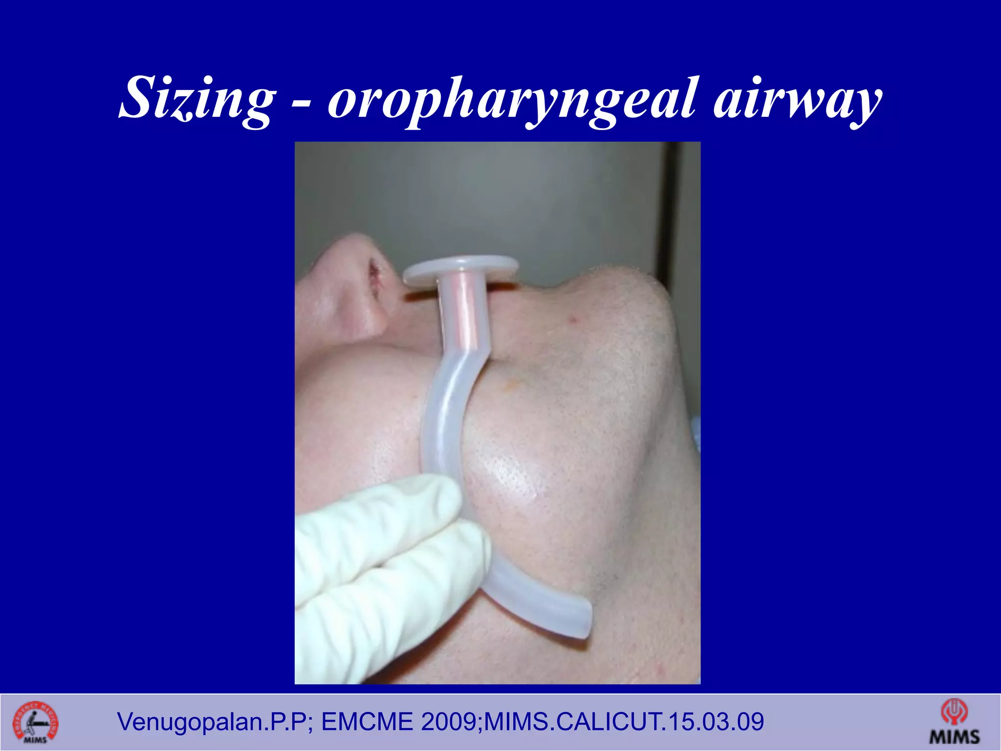 Venugopalan.P.P; EMCME 2009;MIMS.CALICUT.15.03.09
Sizing - oropharyngeal airway
 