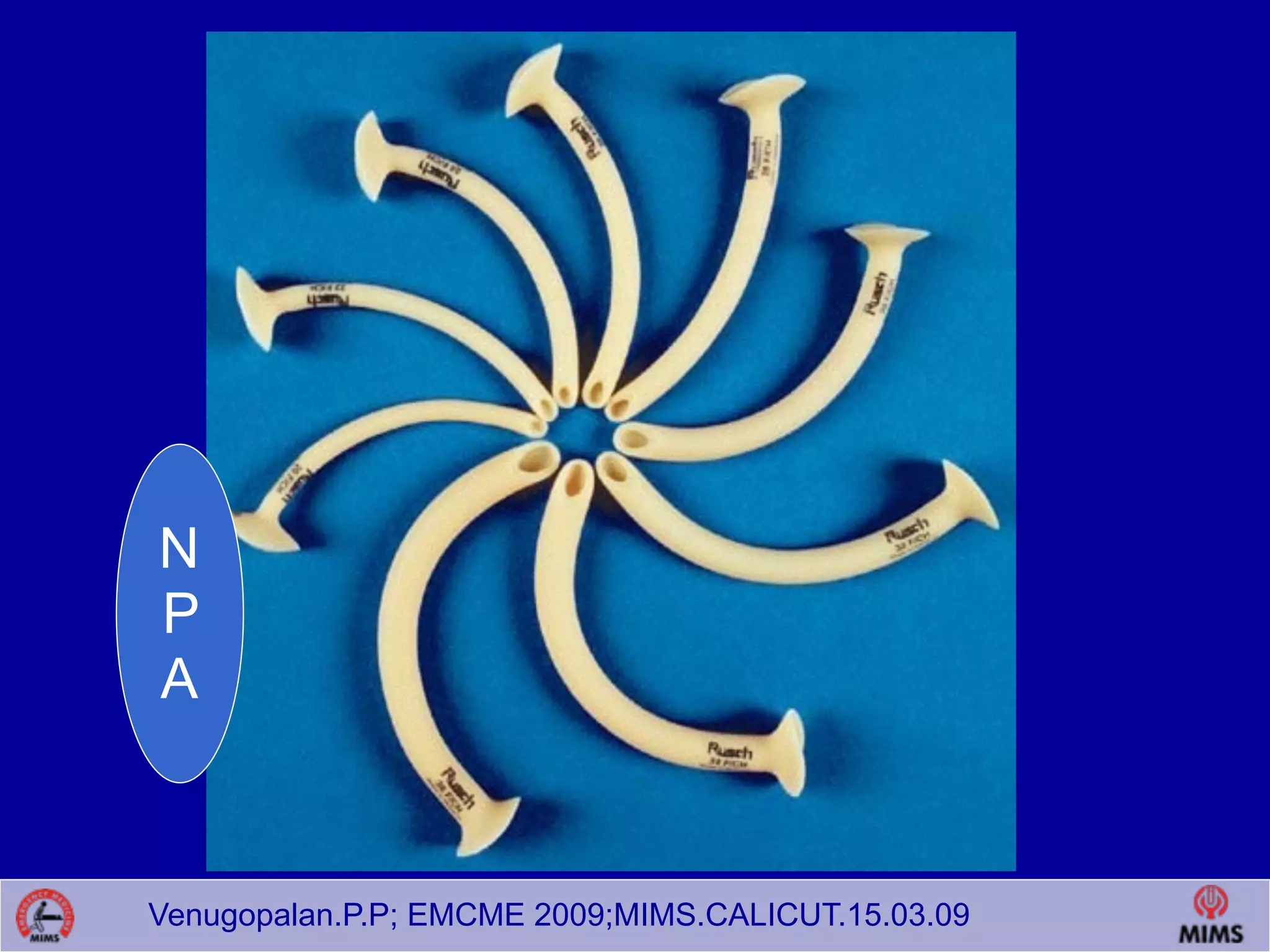 Venugopalan.P.P; EMCME 2009;MIMS.CALICUT.15.03.09
N
P
A
 