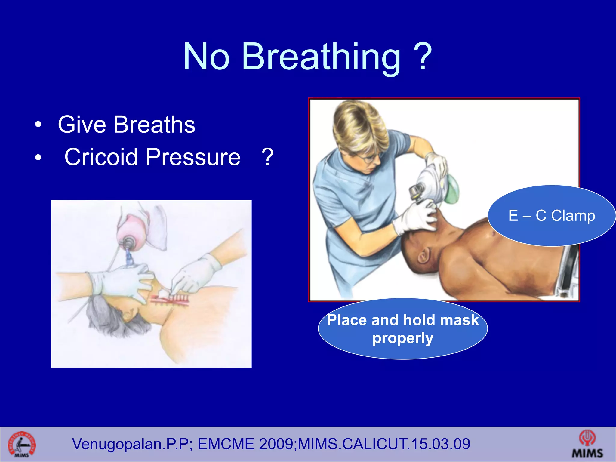 Venugopalan.P.P; EMCME 2009;MIMS.CALICUT.15.03.09
No Breathing ?
• Give Breaths
• Cricoid Pressure ?
E – C Clamp
Place and hold mask
properly
 