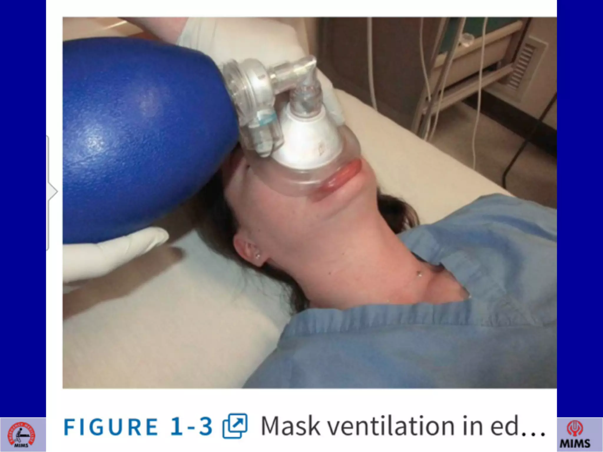 Venugopalan.P.P; EMCME 2009;MIMS.CALICUT.15.03.09
 