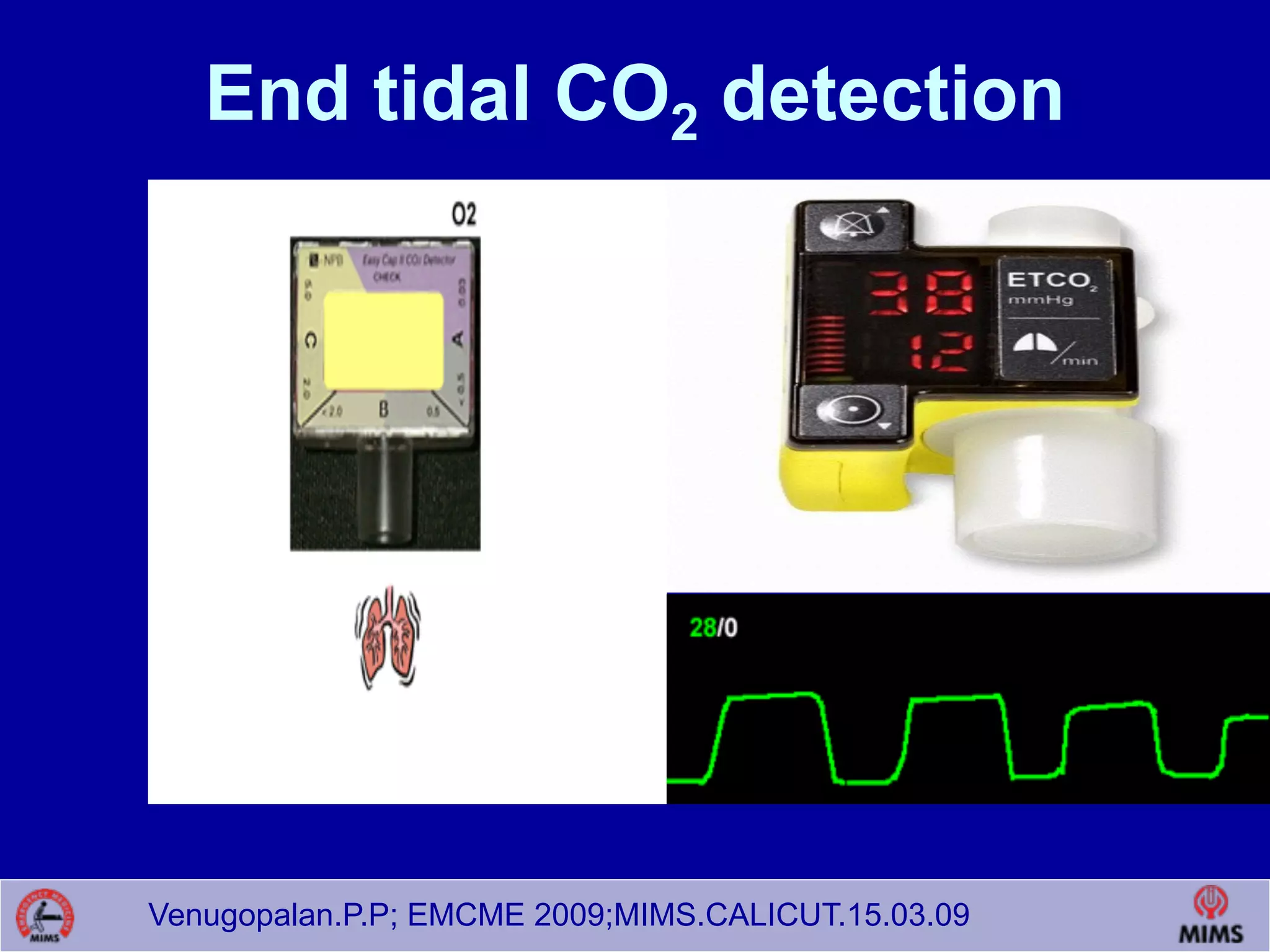 Venugopalan.P.P; EMCME 2009;MIMS.CALICUT.15.03.09
End tidal CO2 detection
 