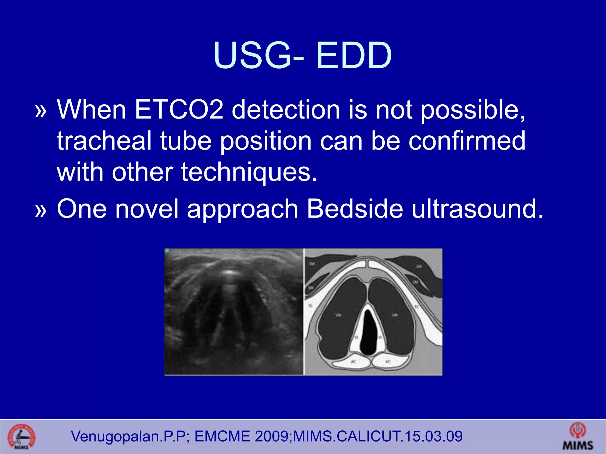 Venugopalan.P.P; EMCME 2009;MIMS.CALICUT.15.03.09
USG- EDD
» When ETCO2 detection is not possible,
tracheal tube position can be confirmed
with other techniques.
» One novel approach Bedside ultrasound.
 