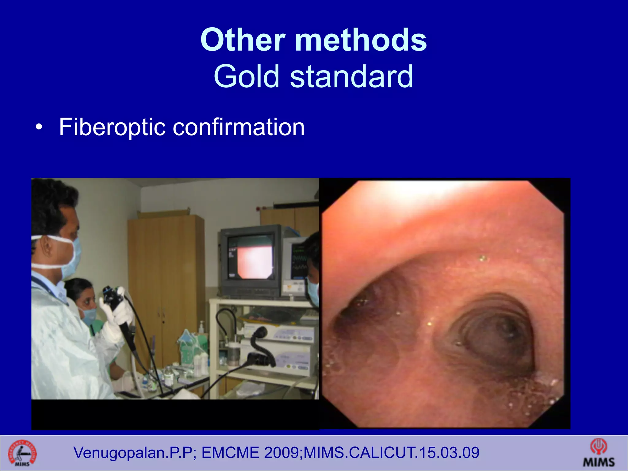 Venugopalan.P.P; EMCME 2009;MIMS.CALICUT.15.03.09
Other methods  
Gold standard
• Fiberoptic confirmation
 