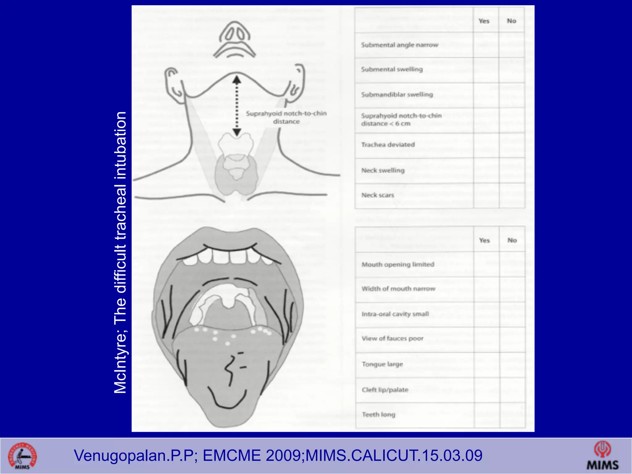 Venugopalan.P.P; EMCME 2009;MIMS.CALICUT.15.03.09
McIntyre;Thedifficulttrachealintubation
 