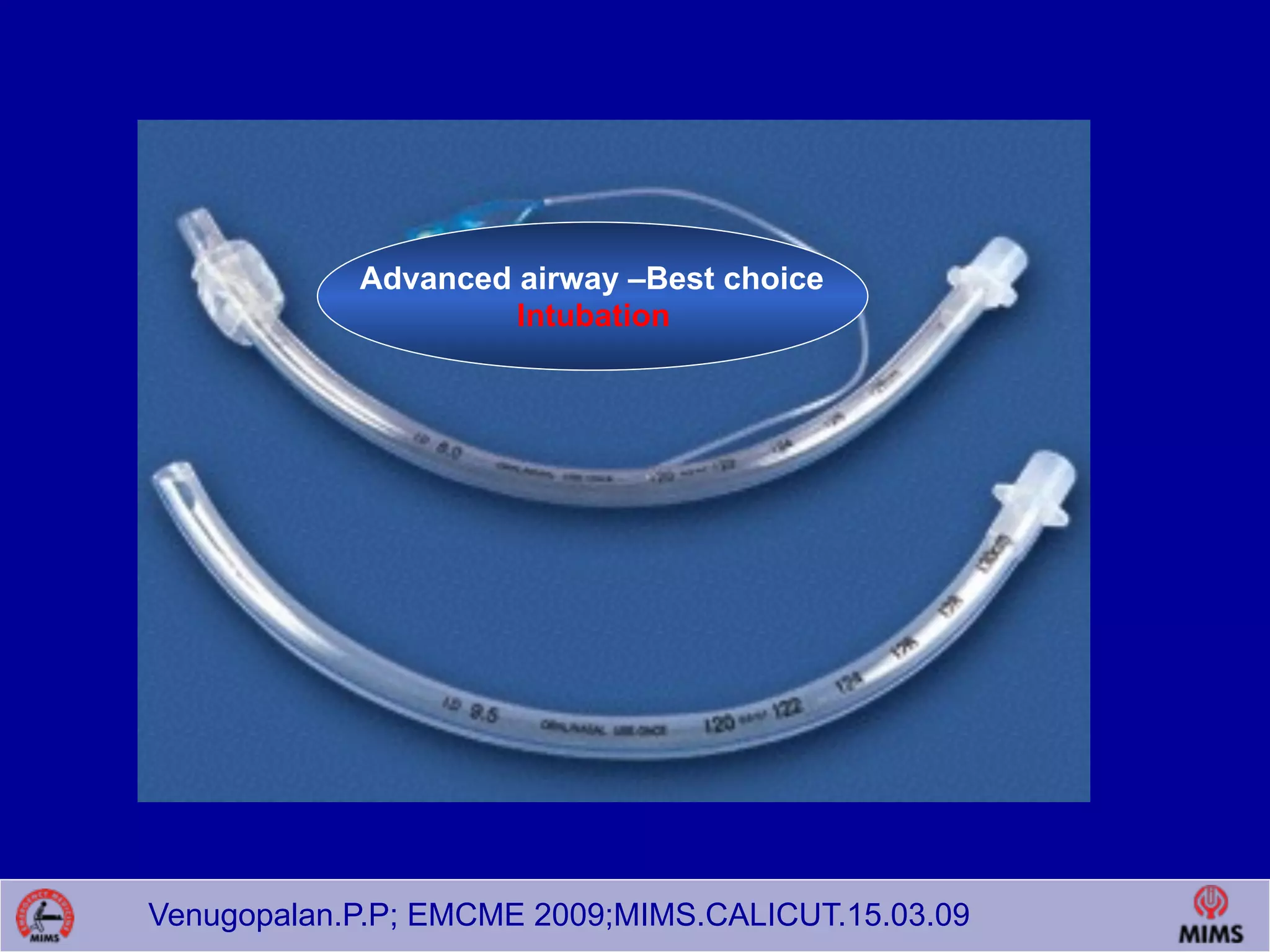 Venugopalan.P.P; EMCME 2009;MIMS.CALICUT.15.03.09
Advanced airway –Best choice
Intubation
 