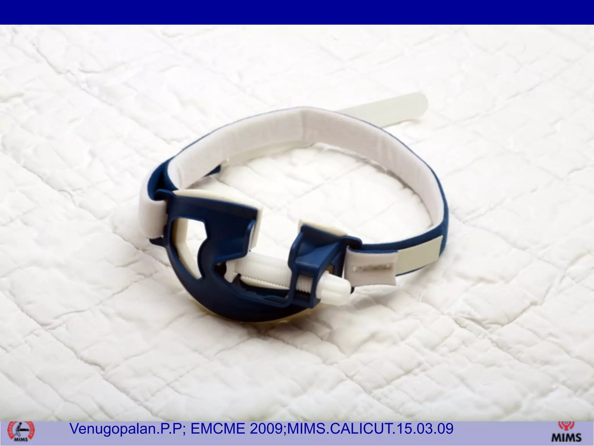 Venugopalan.P.P; EMCME 2009;MIMS.CALICUT.15.03.09
 