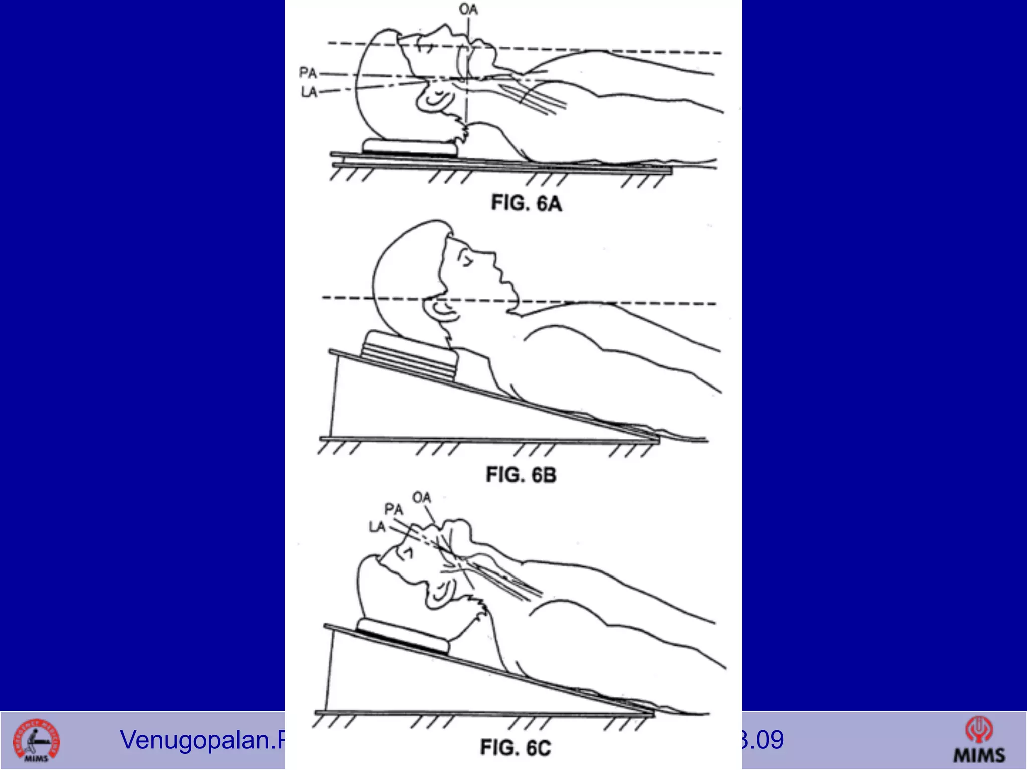 Venugopalan.P.P; EMCME 2009;MIMS.CALICUT.15.03.09
 