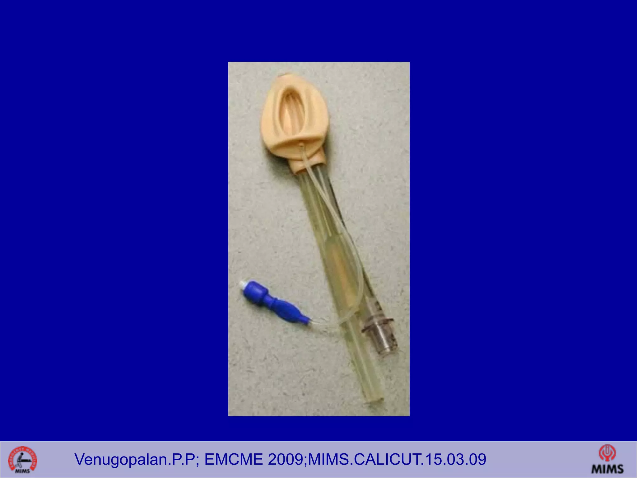Venugopalan.P.P; EMCME 2009;MIMS.CALICUT.15.03.09
 