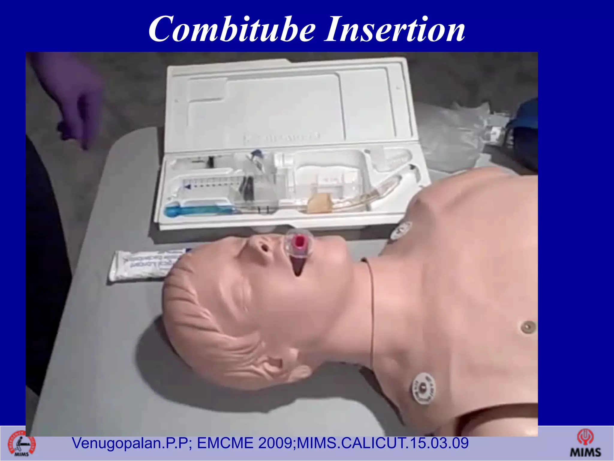 Venugopalan.P.P; EMCME 2009;MIMS.CALICUT.15.03.09
Combitube Insertion
 